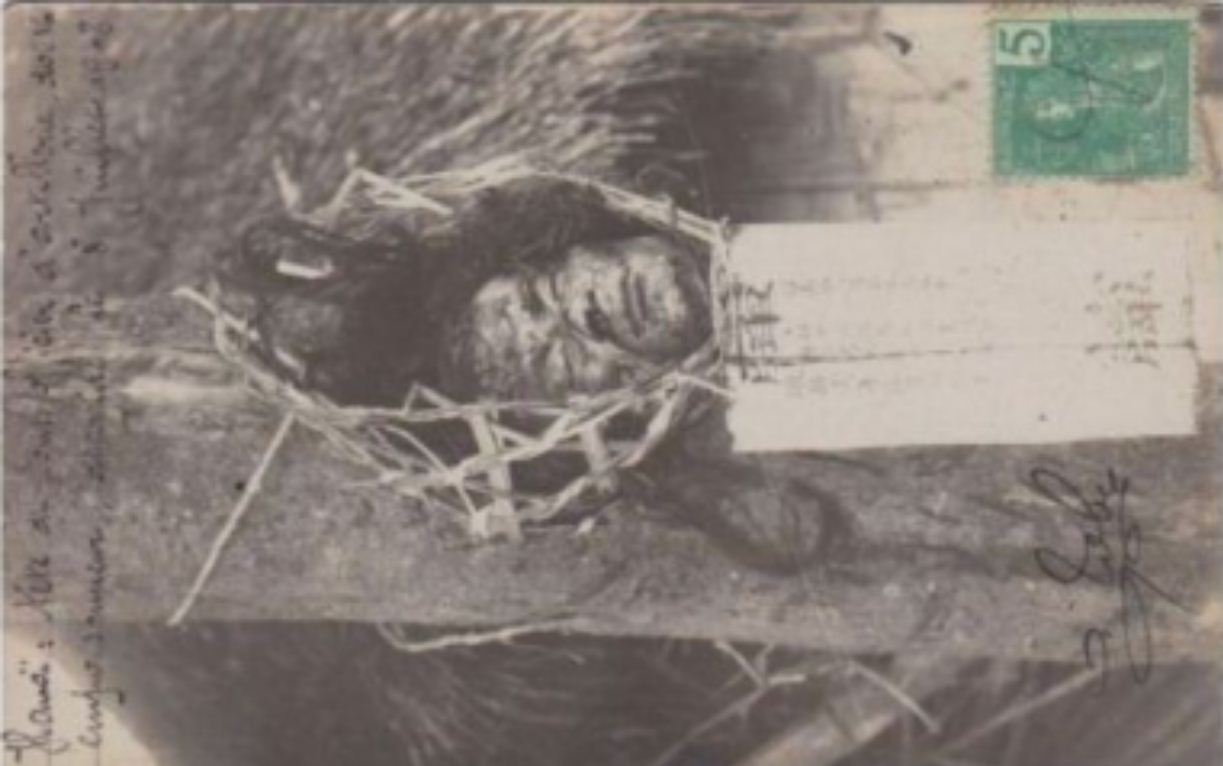  Hanoï : Tête du sous-officier d'artillerie Doï 16, empoisonneur, décapité le 8 juillet 1908.